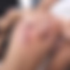 Anal