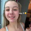 lynntoria pack thumbnail
